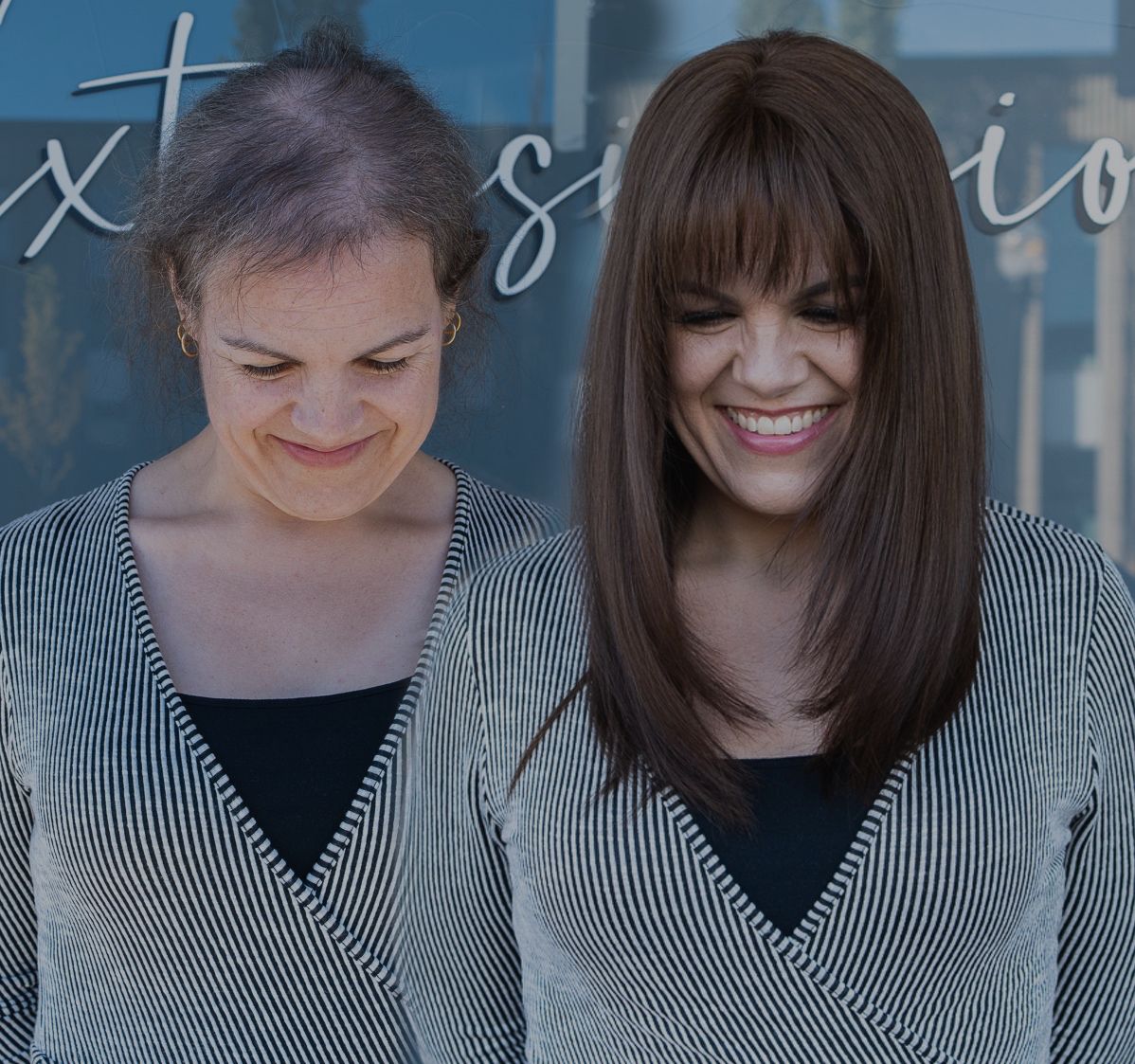 Hair loss client before and after, with soft bangs